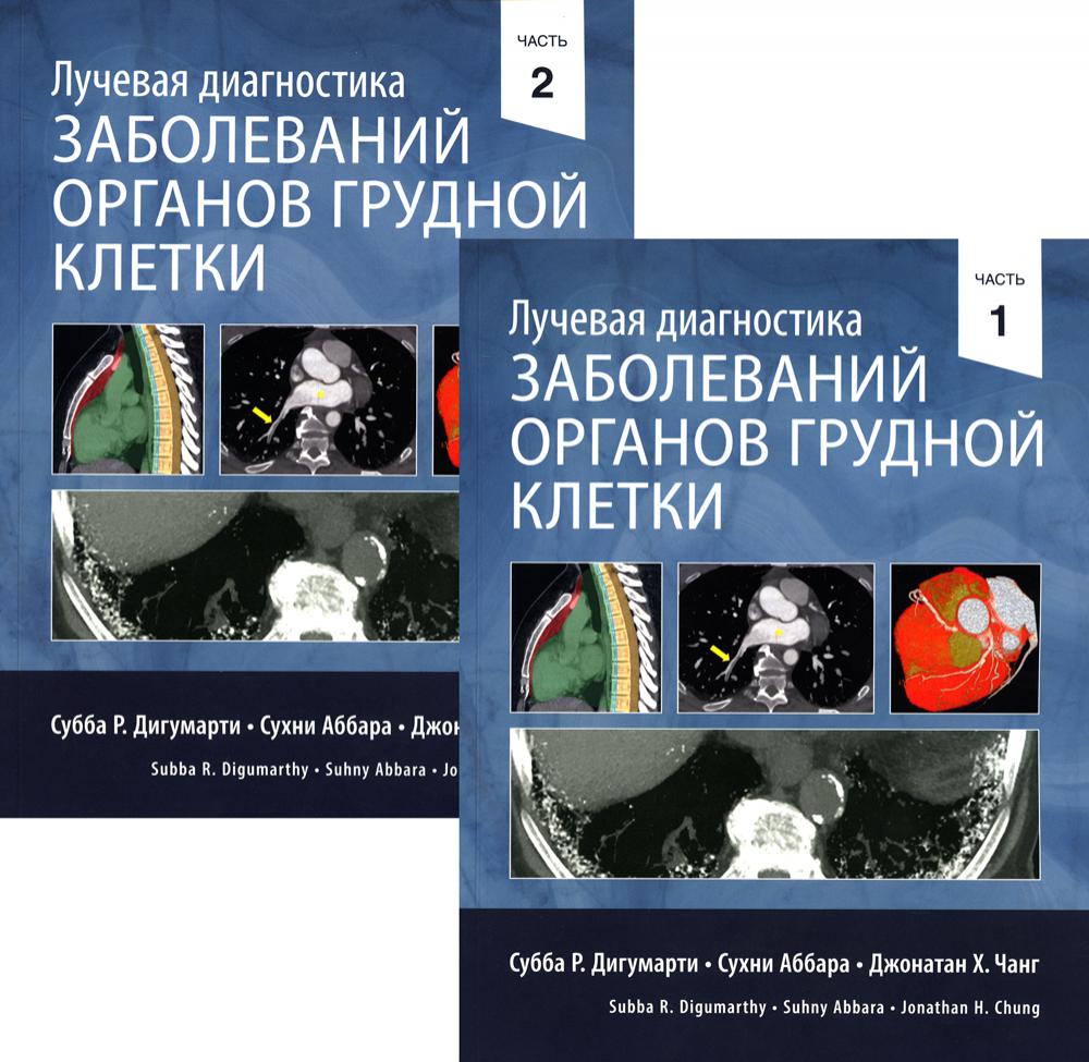 Лучевая диагностика заболеваний органов грудной клетки. В 2 ч