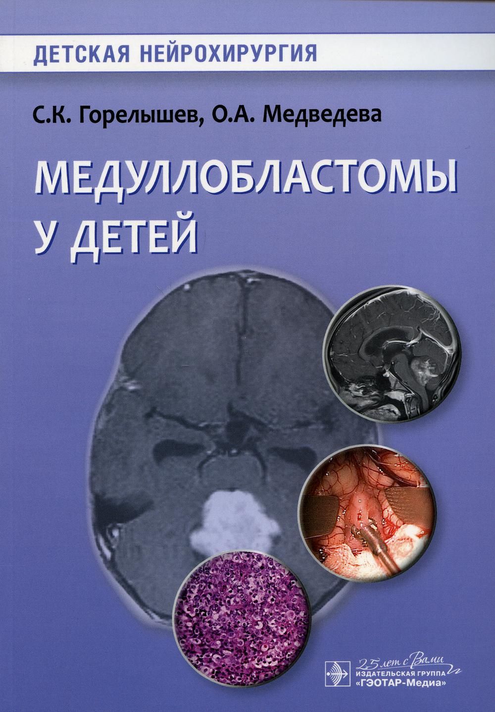 Медуллобластомы у детей