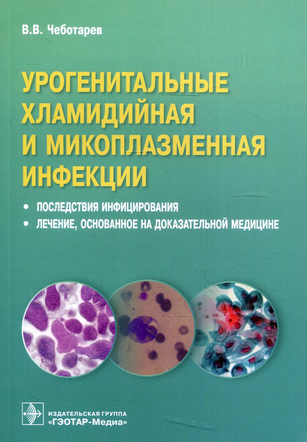 Урогенитальные хламидийная и микоплазменная инфекции. Последствия инфицирования, лечение, основанное на доказательной медицине