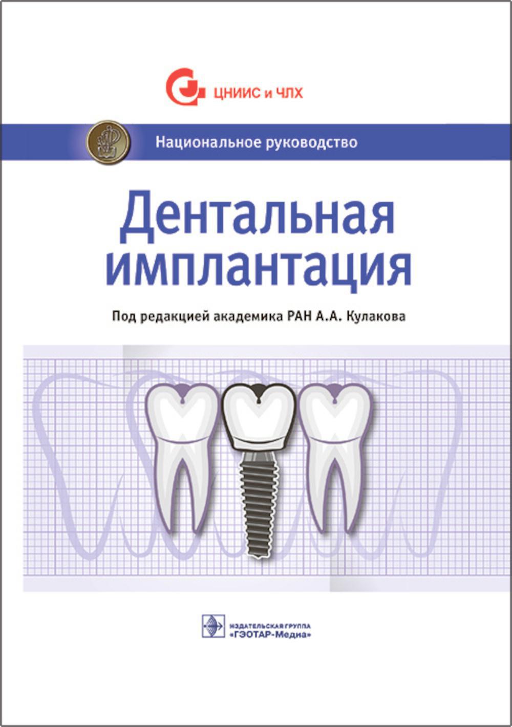 Дентальная имплантация: национальное руководство