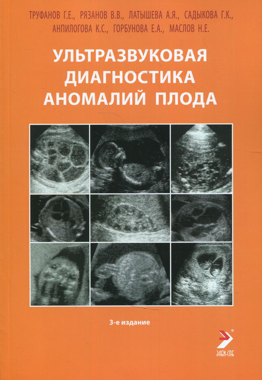 Ультразвуковая диагностика аномалий плода: Руководство для врачей. 3-е изд