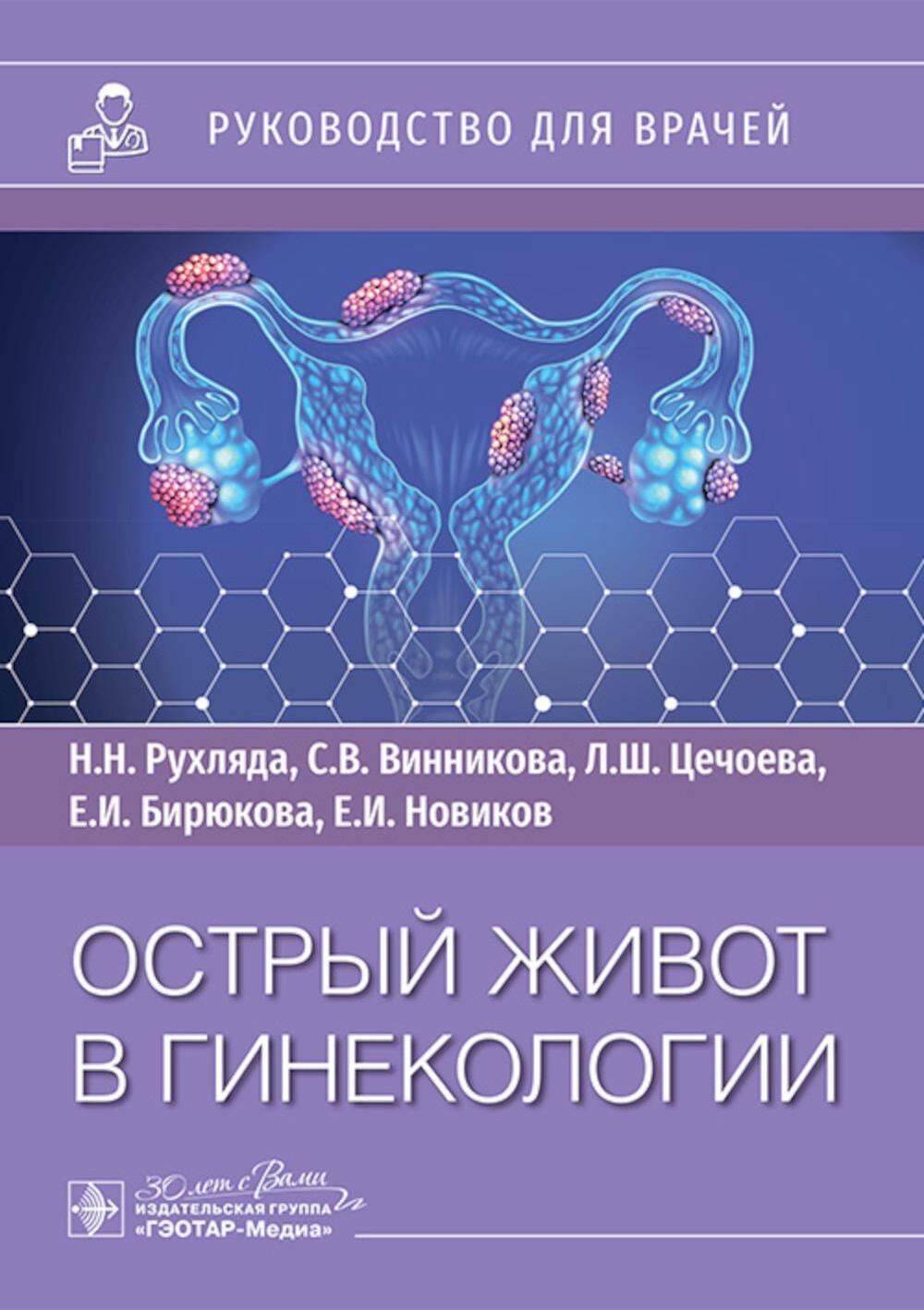 Острый живот в гинекологии: руководство для врачей
