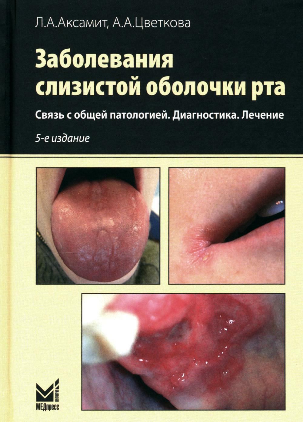 Заболевания слизистой оболочки рта. Связь с общей патологией. Диагностика. Лечение. 5-е изд., перераб.и доп
