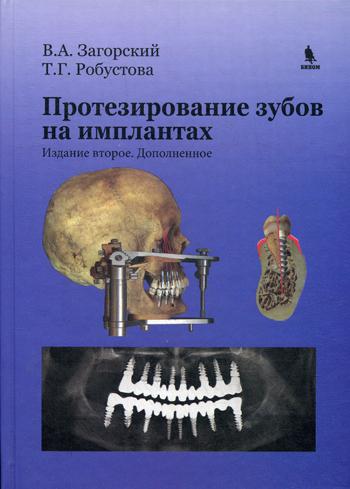 Протезирование зубов на имплантатах. 2-е изд., доп