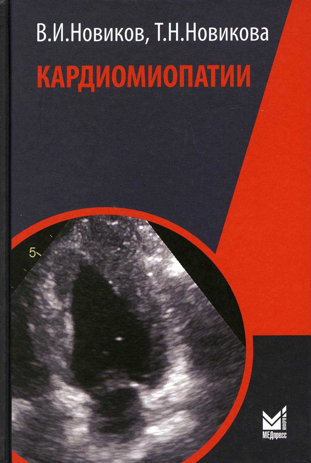 Кардиомиопатии