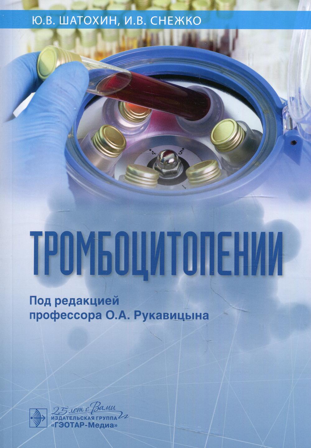 Тромбоцитопении