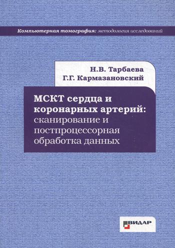 МСКТ сердца и коронарных артерий: сканирование и постпроцессорная обработка данных.