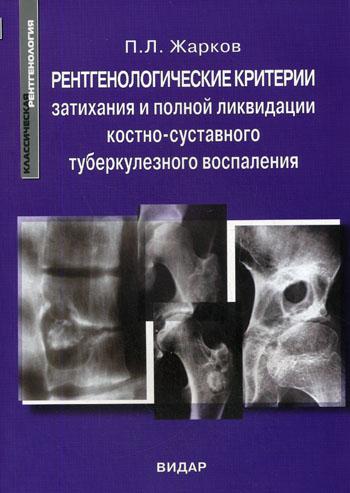 Рентгенологические критерии затихания и полной ликвидации костно-суставного туберкулезного воспаления