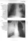Клинико-рентгенологическая диагностика болезней органов дыхания: общая врачебная практика