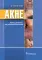 Акне