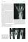 Лучевая диагностика патологии костной ткани. 2-е изд