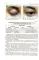 Функциональная и клиническая анатомия органа зрения: руководство для офтальмологов и офтальмохирургов. 2-е изд., перер